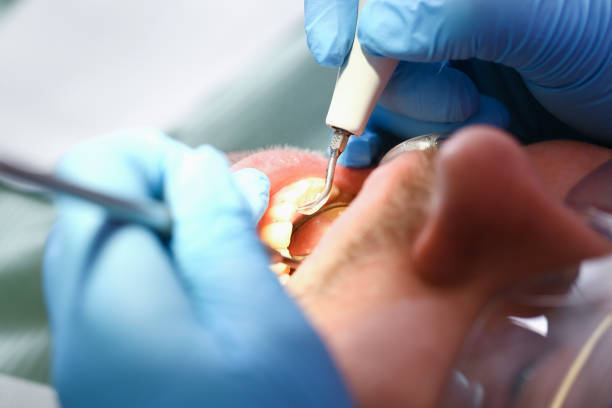 Best Emergency Orthodontic Repairs in Tchula, MS